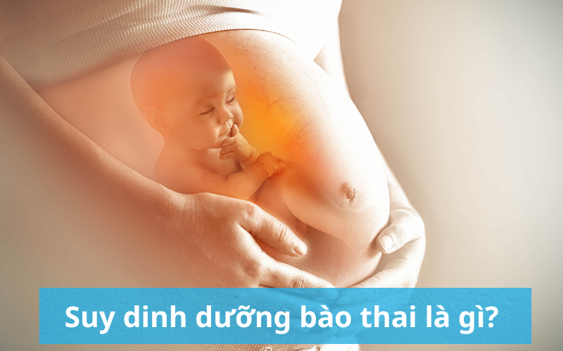 Suy dinh dưỡng bào thai là gì? Làm gì để ngăn ngừa bào thai bị suy dinh dưỡng?