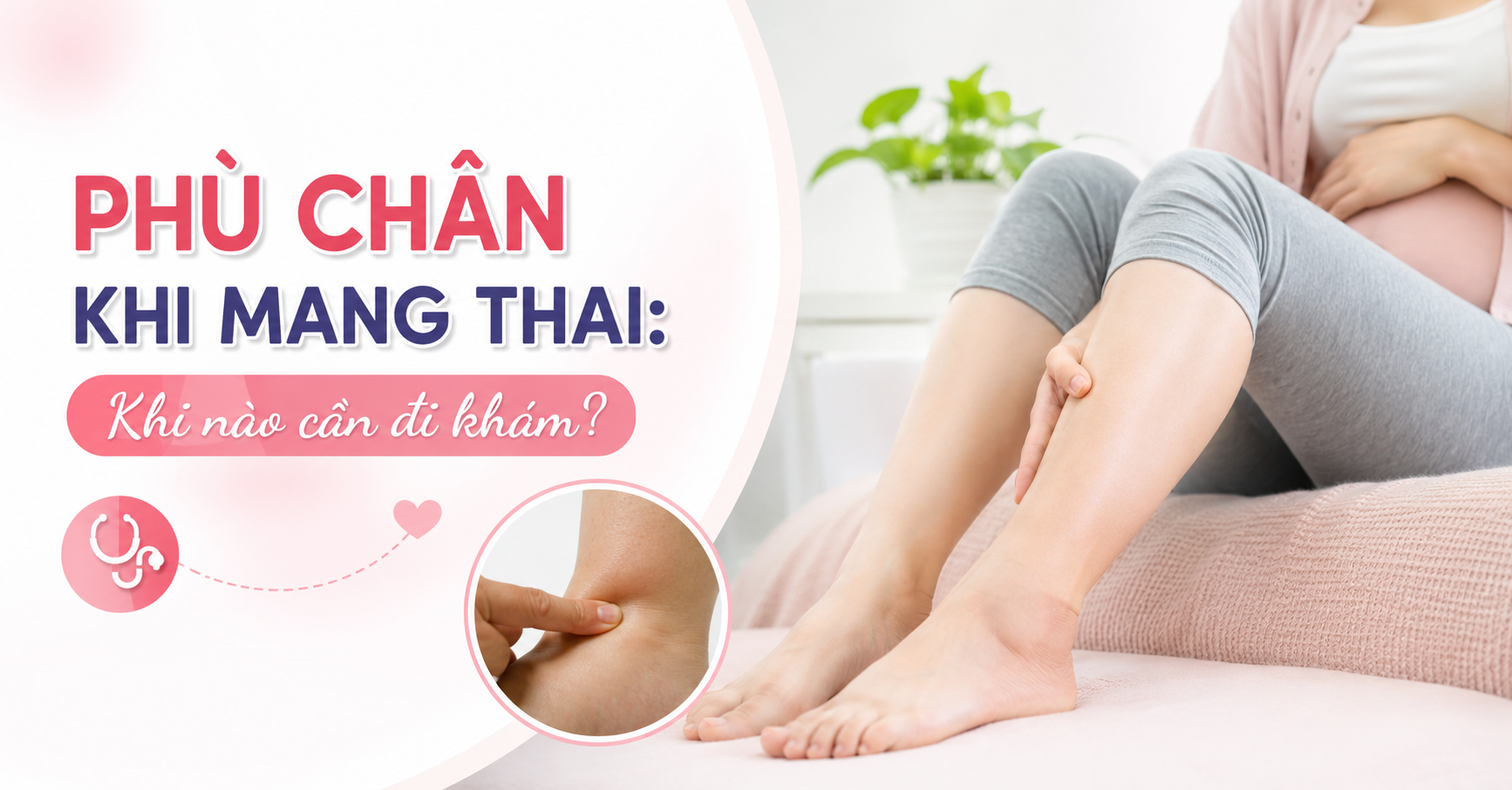 Phù Chân Khi Mang Thai: Khi Nào Cần Đi Khám?